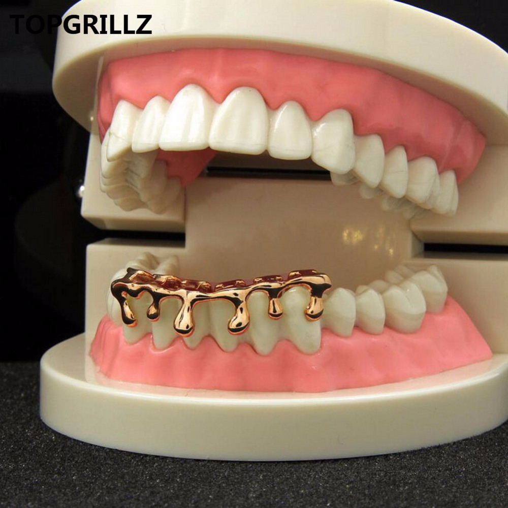 TOPGRILLZ Fit Licht Gelb Gold  – Yellow Body Jewelry Bewertung und Preis